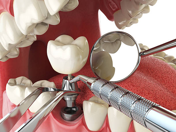 Best Emergency Orthodontic Repairs in Oral City, FL